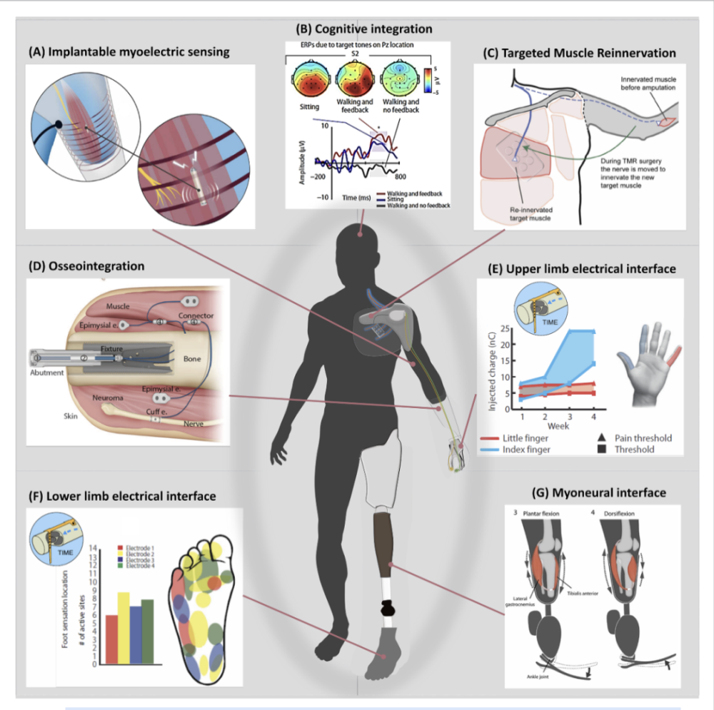Clinical Translation of Bionic Limbs: Neural Interfaces ...